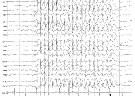 115-2-iline.gif